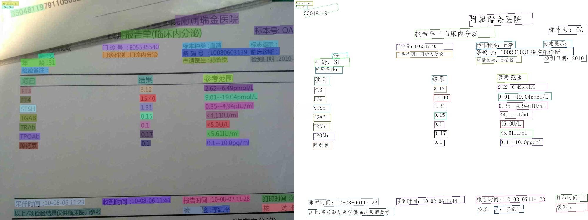 PaddleOCR 2025智能文字识别系统源码 图片